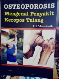 Image of OSTEOPOROSIS MENGENAL PENYAKIT KEROPOS TULANG